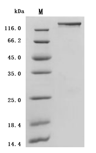 SDS-PAGE