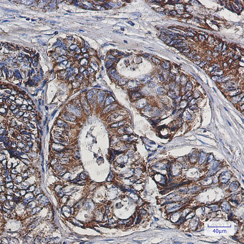 Валидация AntibodySystem RHF45501
