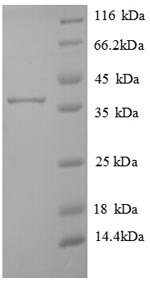 SDS-PAGE