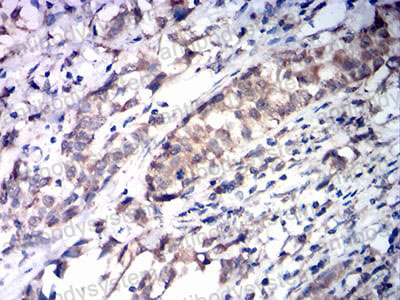 Валидация AntibodySystem RHD48501