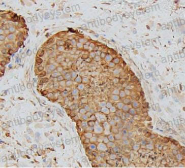 Валидация AntibodySystem RHF62203