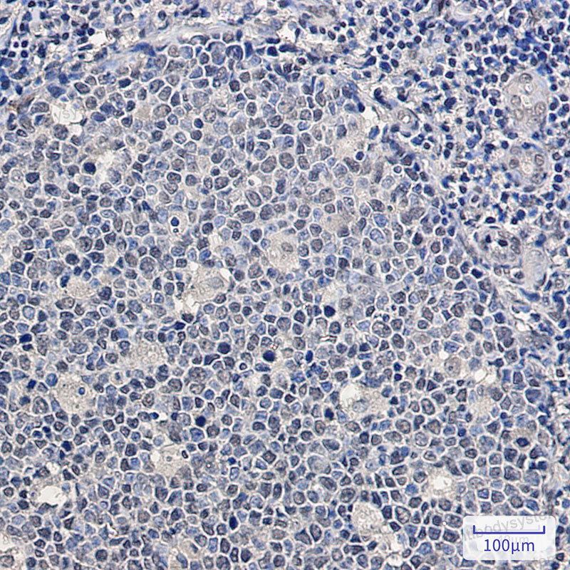 Валидация AntibodySystem RHG14301