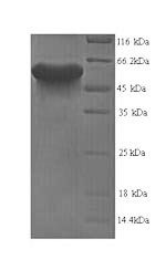 SDS-PAGE