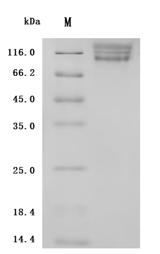 SDS-PAGE