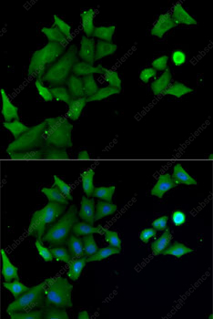 Иммунофлуоресценция, HABP2, клетки MCF7