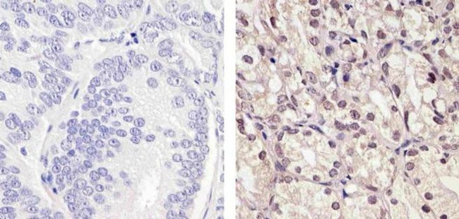 Валидация AssayVector ARM1253(661)