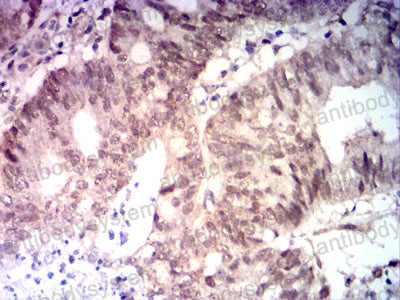 Валидация AntibodySystem RHE27606 (2056)