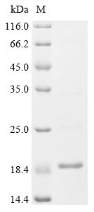 SDS-PAGE