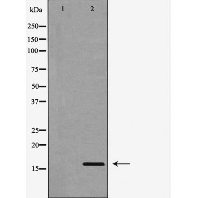 Валидация Affinity DF6457 - 17841