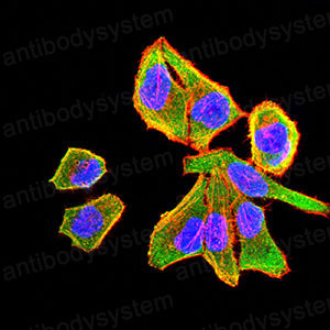 Валидация IF - AntibodySystem RHD80701 (726)