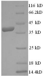 SDS-PAGE