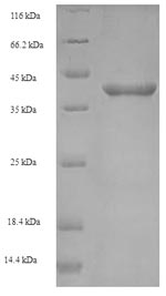 SDS-PAGE