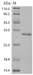 SDS-PAGE