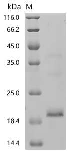 SDS-PAGE