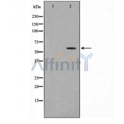 Валидация Affinity DF3590 - 14550