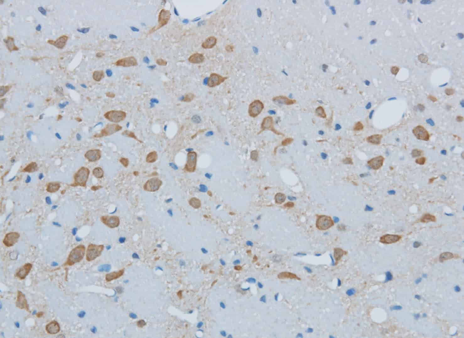 Валидация Elabscience E-AB-40161