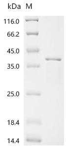 SDS-PAGE