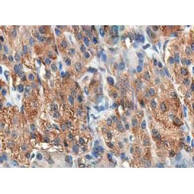 Валидация Affinity DF8515 - 20379