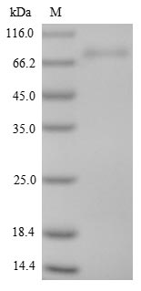 SDS-PAGE