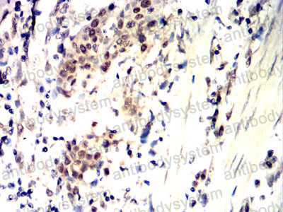 Валидация AntibodySystem RHC90505 (1162)