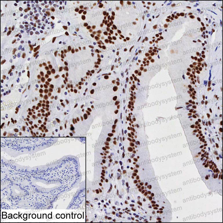Валидация AntibodySystem RHD84705