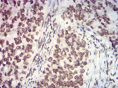 Валидация AntibodySystem RHE91303 (2388)