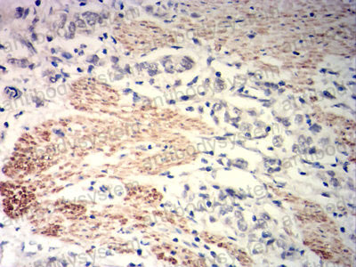 Валидация AntibodySystem RHH18202