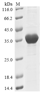 SDS-PAGE