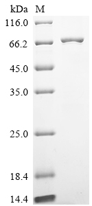 SDS-PAGE
