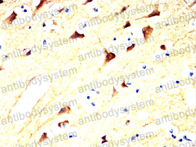 Валидация AntibodySystem RHC44502 (1035)