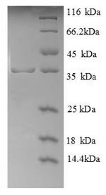 SDS-PAGE
