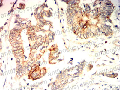 Валидация AntibodySystem RHE77503 (2318)