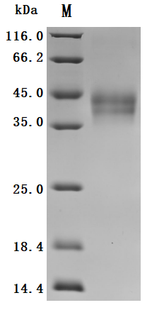 SDS-PAGE