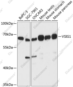 Вестерн-блоттинг, VSIG1, различные клеточные линии
