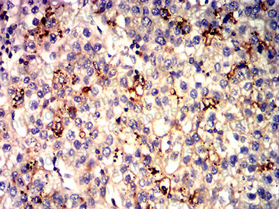 Валидация AntibodySystem RHE84611