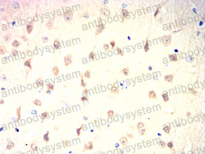 Валидация AntibodySystem RHC44503 (1043)