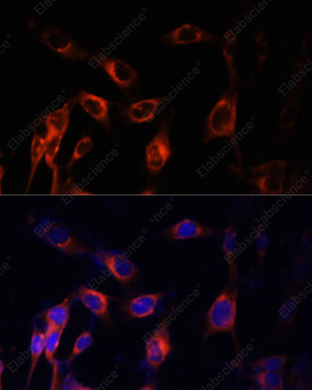 Иммунофлуоресценция, TSC1, клетки NIH-3T3
