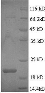 SDS-PAGE