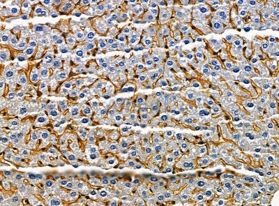 Валидация Affinity DF14452 - 10424