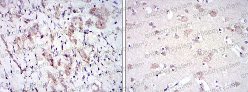 Валидация AntibodySystem RHC19302