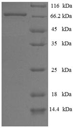 SDS-PAGE