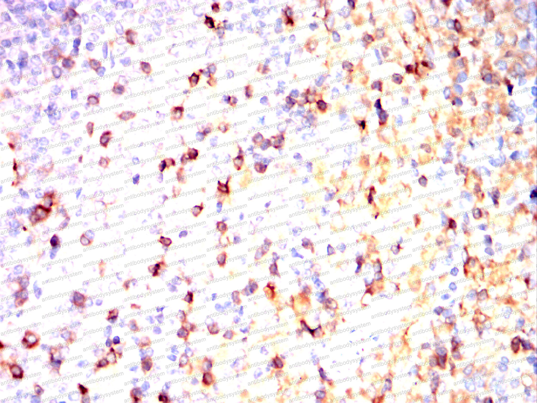 Валидация AntibodySystem RHC07802 (598)