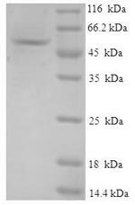 SDS-PAGE