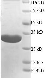 SDS-PAGE