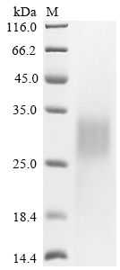 SDS-PAGE