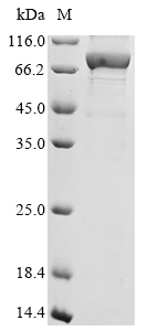 SDS-PAGE