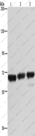 Вестерн-блоттинг, PCK2, клетки 293T, Jurkat и HeLa