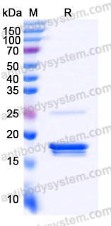 YHJ54402, SDS-PAGE