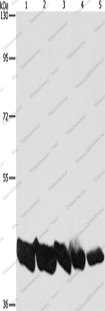 Вестерн-блоттинг, PGK1, клетки A549, HeLa, HepG2 и ткань печени мыши и человека