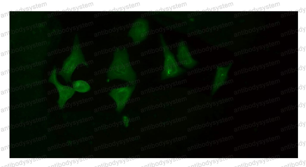 Валидация IF - AntibodySystem RHK37301